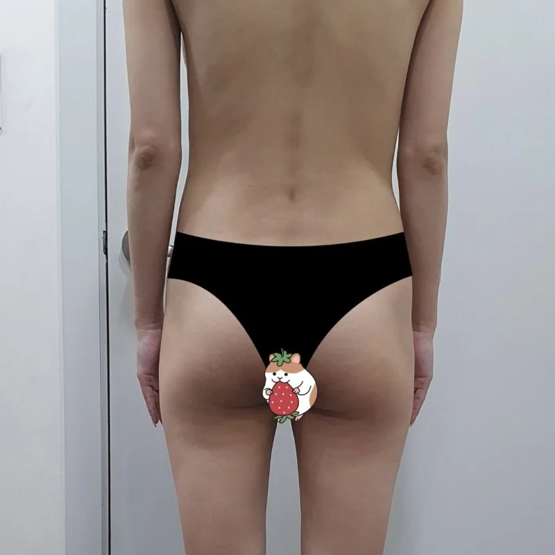 My waist came in and I have hips now!! - Abdominal Liposuction (Upper Body) Before 2 - TheLINE Plastic Surgery