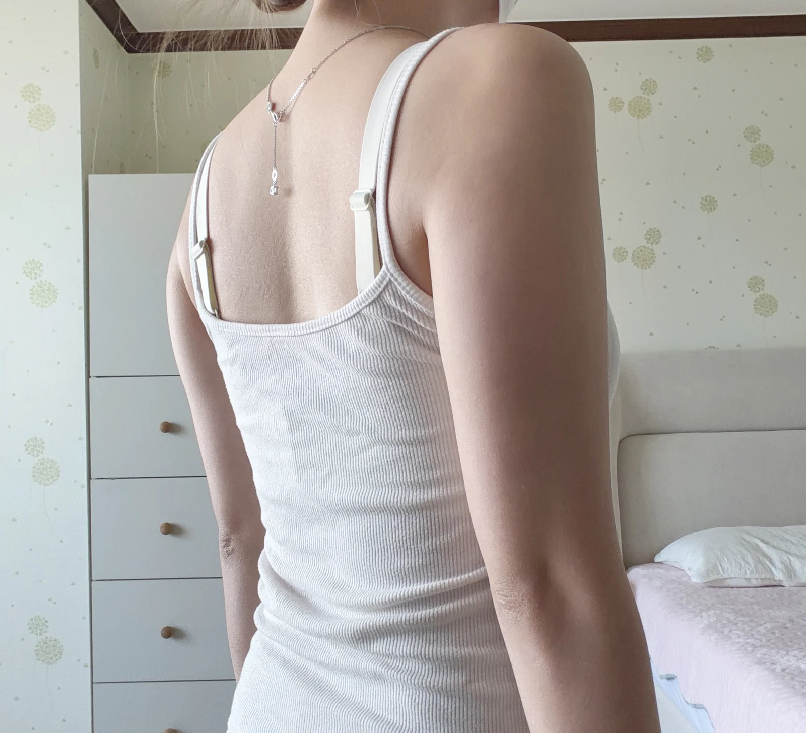 One month after arm lipo! - Arm Liposuction Before 2 - TheLINE Plastic Surgery