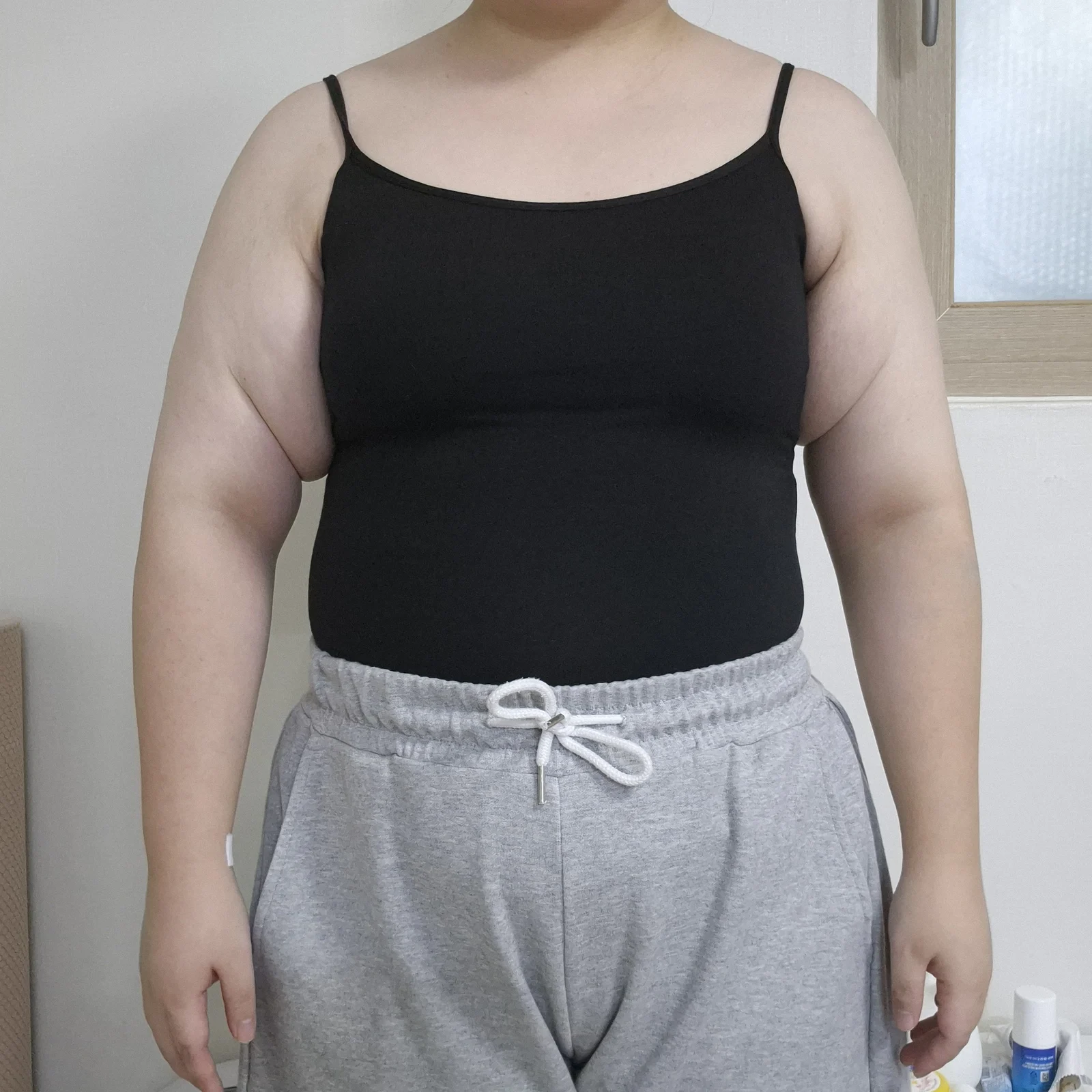 I had an arm lift and arm lipo together! - Body Contouring Before 2 - TheLINE Plastic Surgery