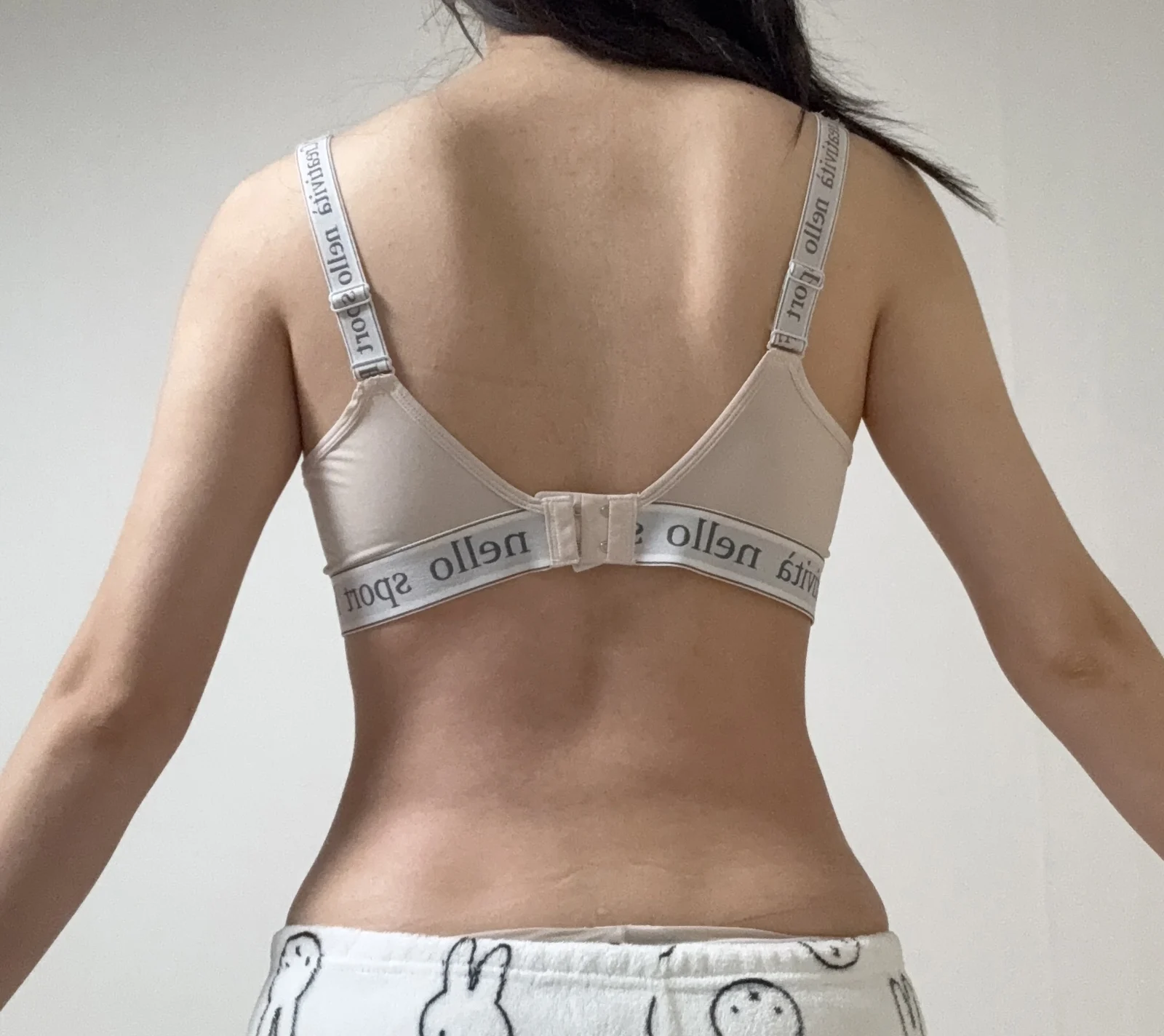 Hello! This is my 6-month review ^^ - Arm Liposuction After 4 - TheLINE Plastic Surgery