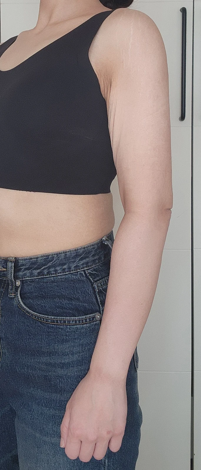 Posting my one-month before and after re - Body Contouring Before 2 - TheLINE Plastic Surgery