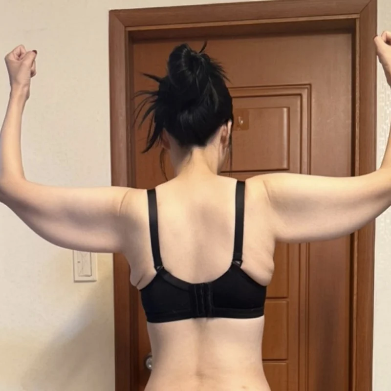 Stem cell lift + lipo surgery - Other Liposuction Before 2 - TheLINE Plastic Surgery