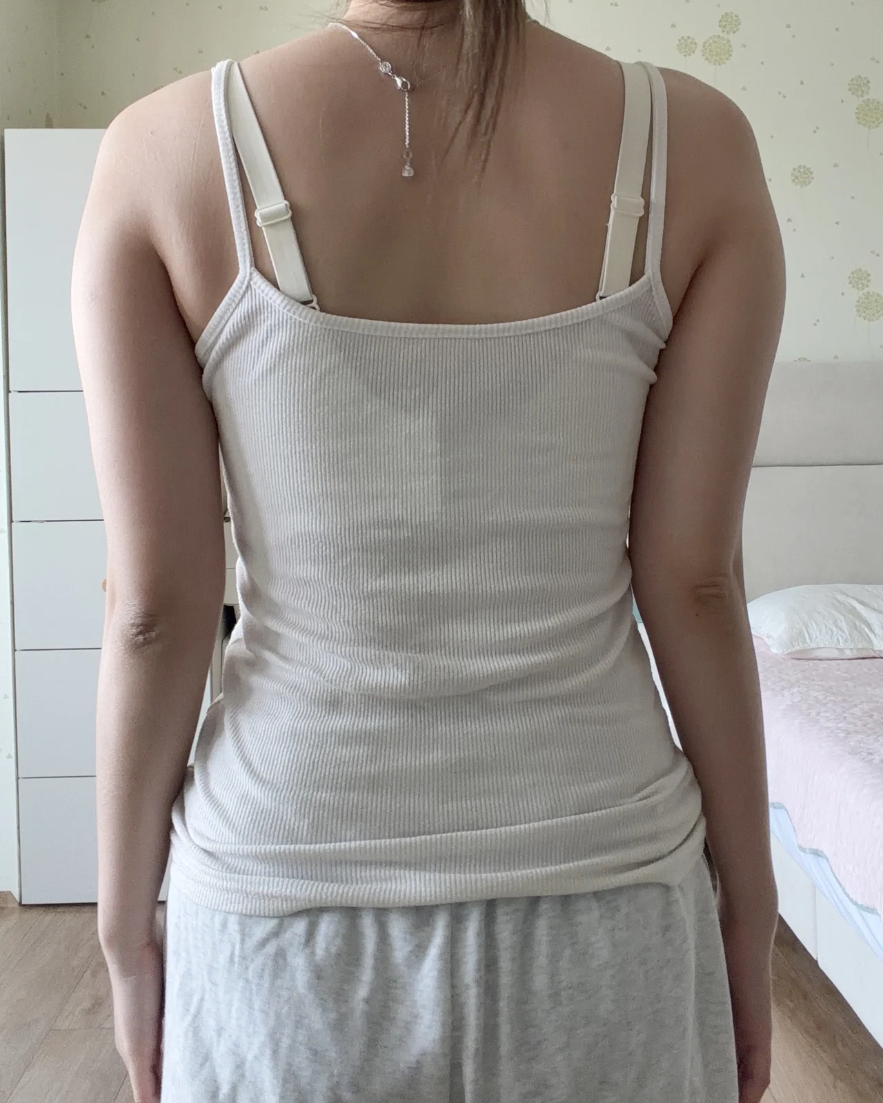 It is month 3 after my arm lipo! - Arm Liposuction Before 2 - TheLINE Plastic Surgery