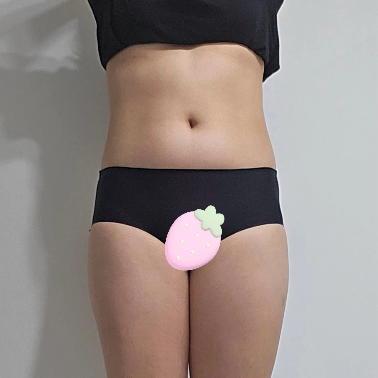 Abdomen and thighs slimmed, hip dips gra - Hip Fat Grafting Before 2 - TheLINE Plastic Surgery
