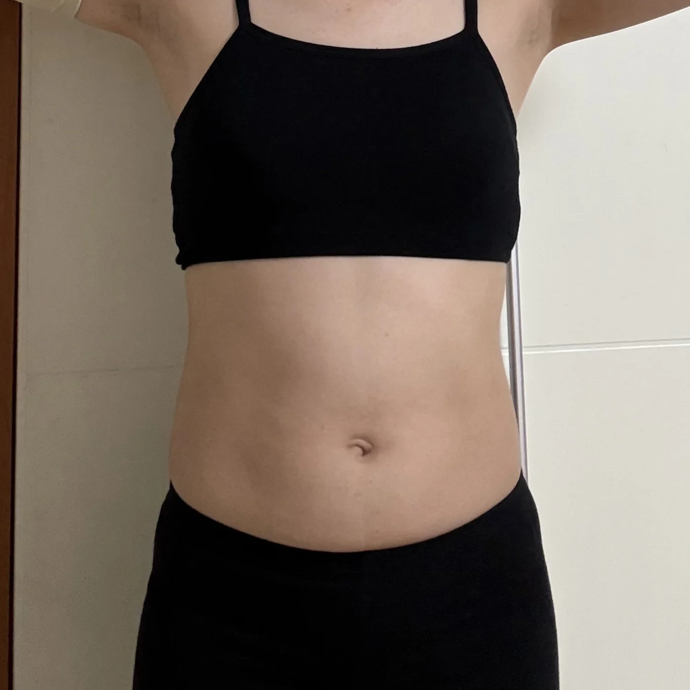 ~Month 6 review of my abdominal lipo wit - Abdominal Liposuction (Upper Body) surgery Before photo - TheLINE Plastic Surgery