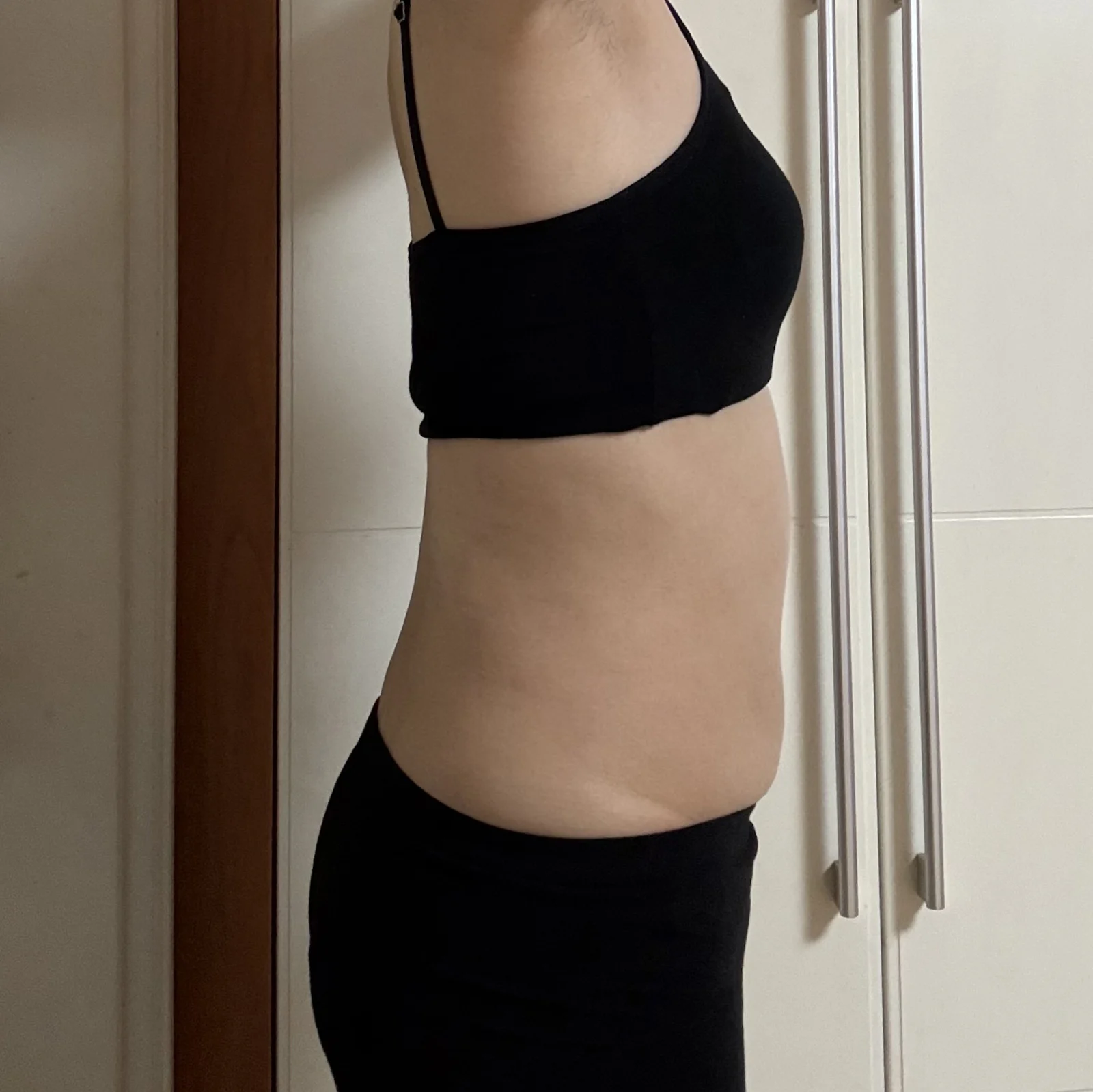 ~Month 6 review of my abdominal lipo wit - Abdominal Liposuction (Upper Body) Before 2 - TheLINE Plastic Surgery
