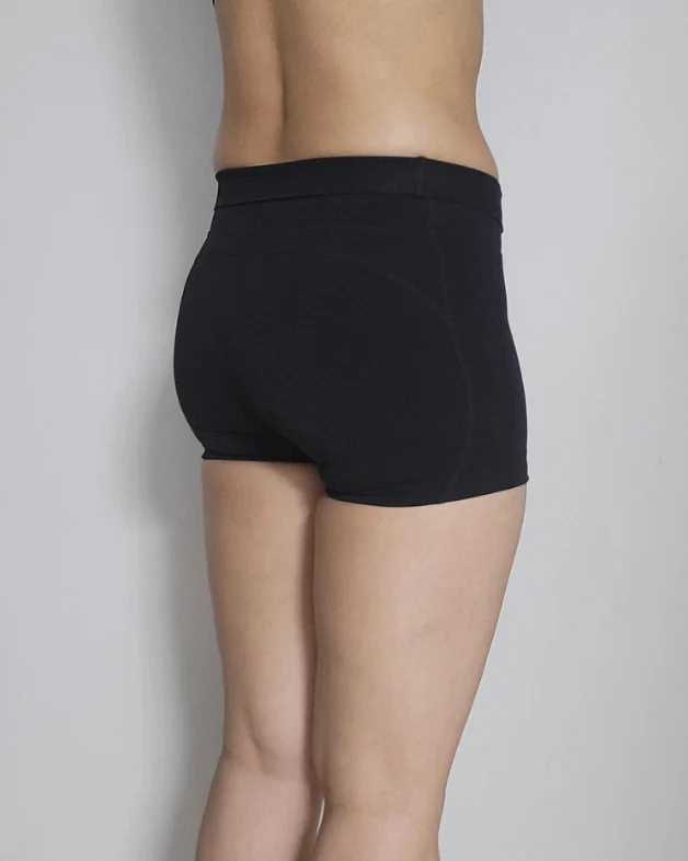 The go-to place for a beautiful back lin - Hip Fat Grafting Before 2 - TheLINE Plastic Surgery