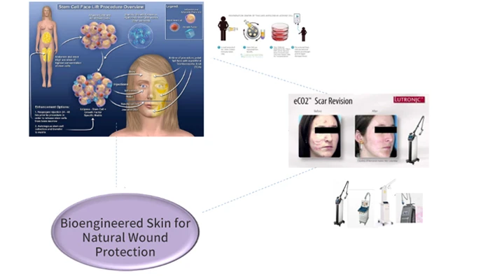 TheLINE SVF scar treatment full-layer skin remodeling - TheLINE Plastic Surgery