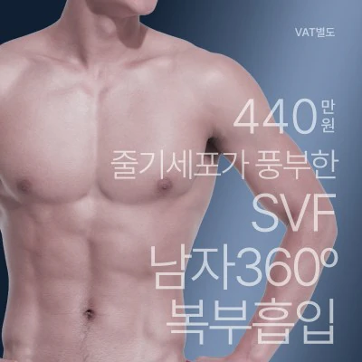 SVF 남자 360° 복부흡입 이벤트 - 더라인성형외과