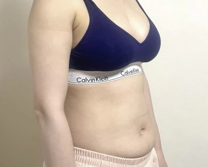 쿼카yeiMn님의 리얼 후기 사진