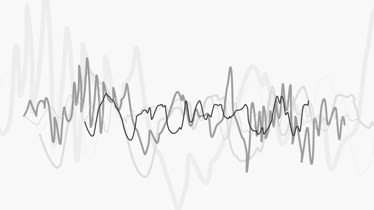 Illustration: EEG-Kurven einer Hirnstrommessung während unterschiedlicher Schlafphasen.