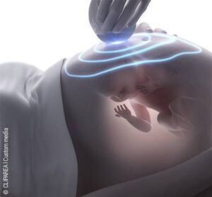 Ein Babybauch durch dessen Hülle das Kind zu sehen ist. Eine Hand setzt eine Glaskugel auf den Bauch, von der aus sich konzentrische Kreise blauen Lichts über den Bauch ausbreiten.