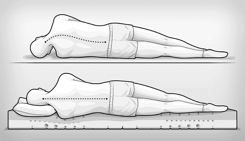 zweigeteilte Illustration: obere Hälfte: eine Person liegt in Seitenlage auf einem harten Untergund, im Schulterbereich wird die Wirbelsäule infolgedessen nach oben gedrückt, der Kopf sinkt ungestützt zu Boden und die Halswirbelsäule ist abgeknickt. Untere Bildhälfte: Die Person liegt in Seitenlage, die Schulter sinkt in eienr Matratze ein, der Kopf ist auf einem Kissen gelagert, die Wirbelsäule ist gerade