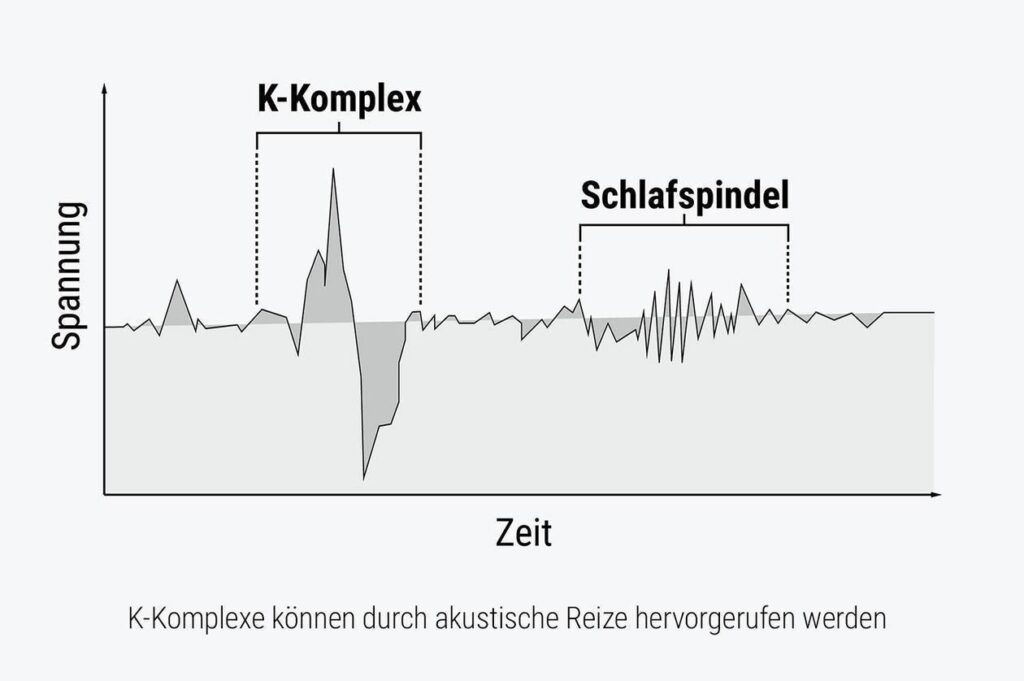 Illustration: Aufzeichnung der akkustischen Störgeräuche des K-Komplex und einer Schlafspindel.