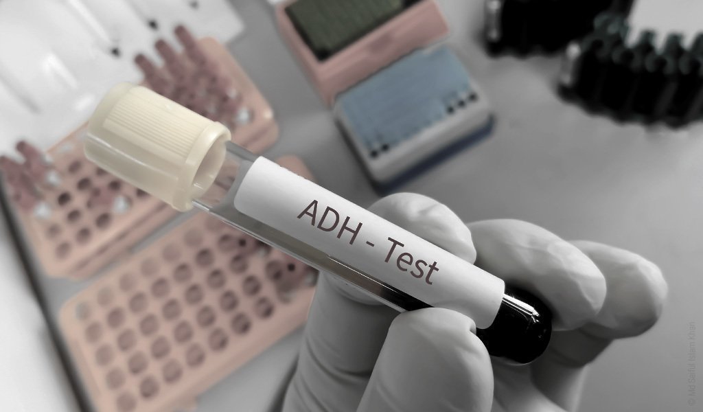 Foto: Eine Hand mit Plastikhandschuhen hält ein Blutentnahmeröhrchen mit der Aufschrift „ADH – Test“ über einem Tisch mit weiteren Laborutensilien.