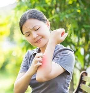 Woman scratching arm due to poison ivy