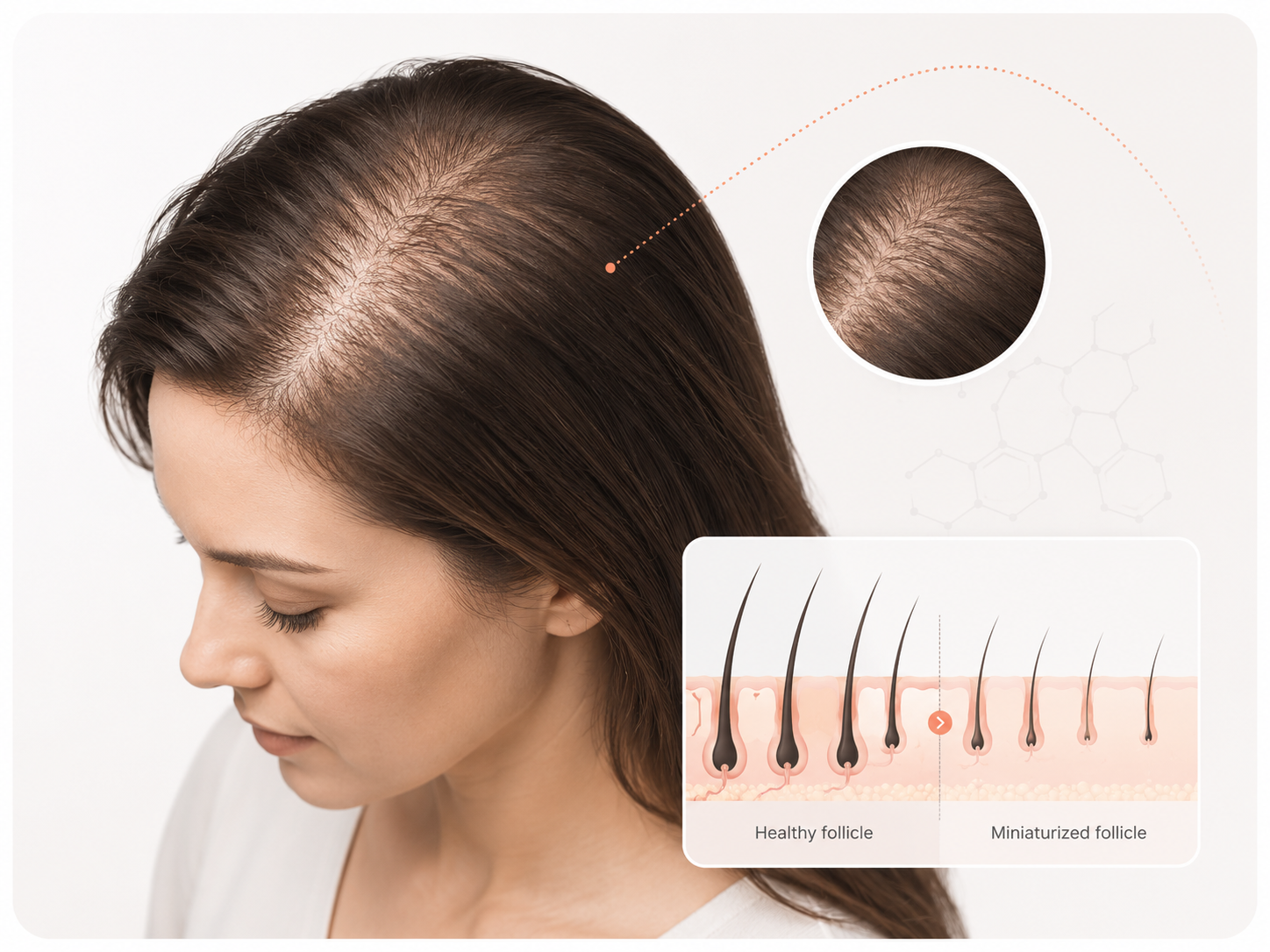 Hair Loss & Thinning