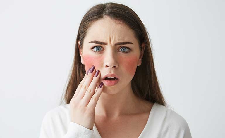 mulher tocando as bochechas que estão com rosacea