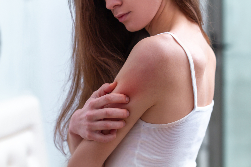 Living with Eczema: Tips & Guide - Travocure