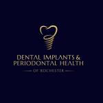 DENTAL IMPLANTS And PERIODONTAL HEALTH