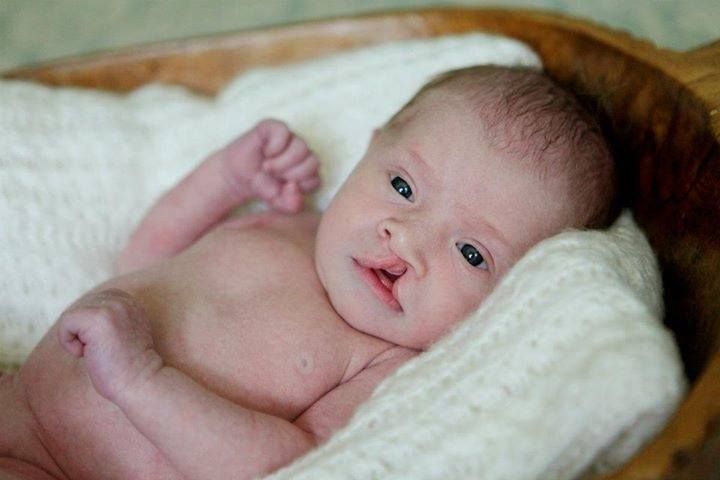 Our sweet child 8 days old