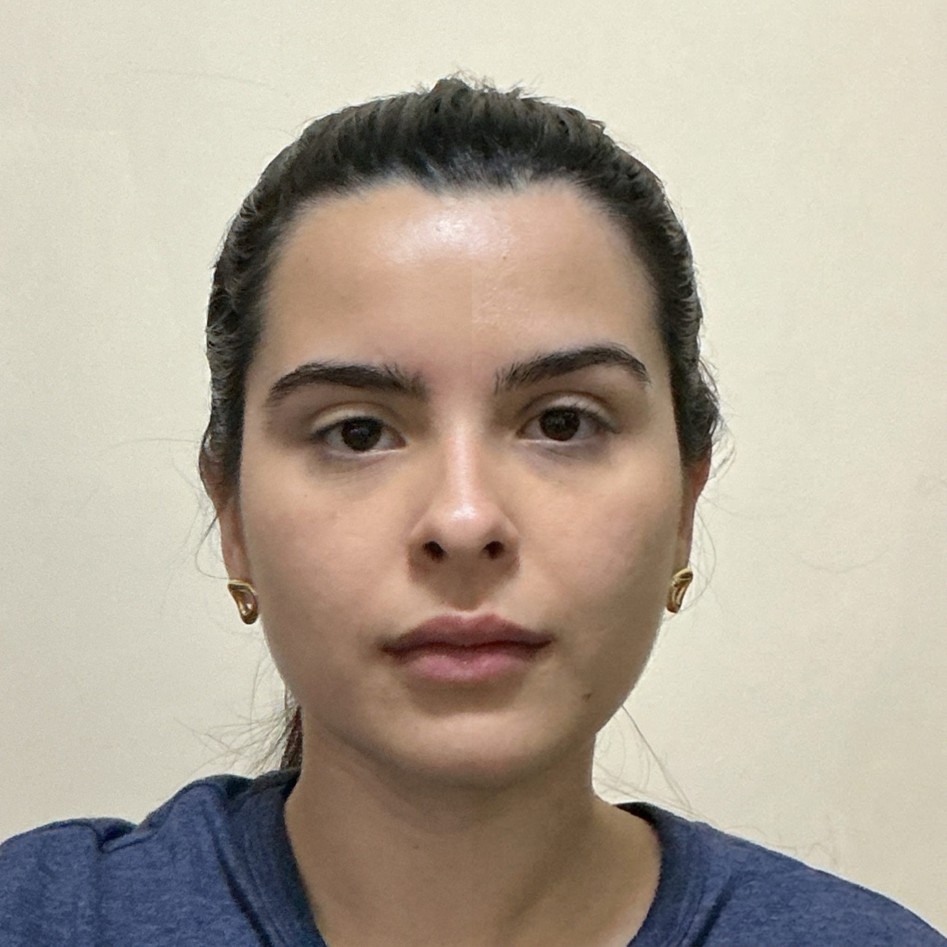 Front Comparison Brow Lift Simulation