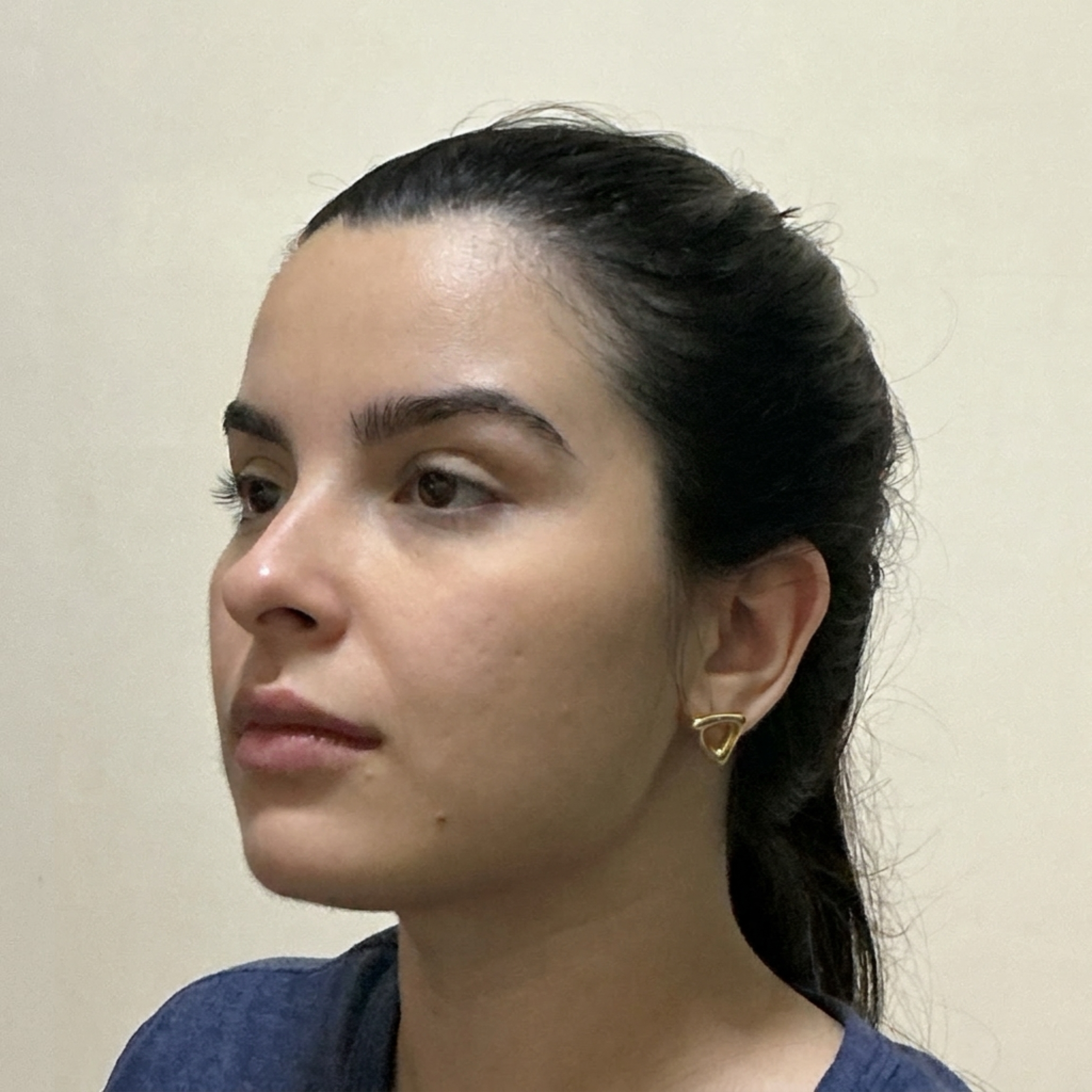Side Comparison Brow Lift Simulation