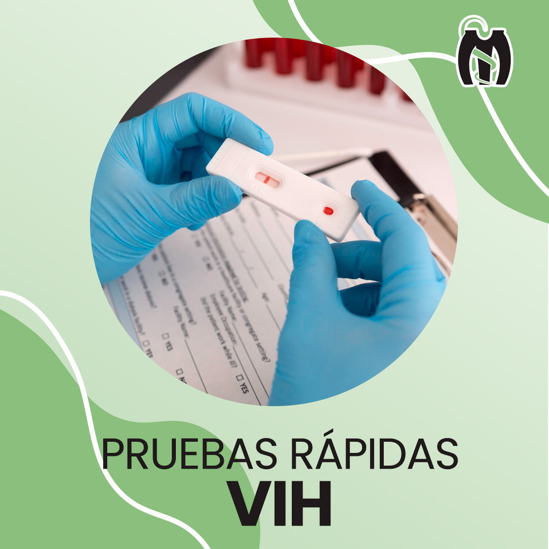 SERVICIO TEST RÁPIDO VIH