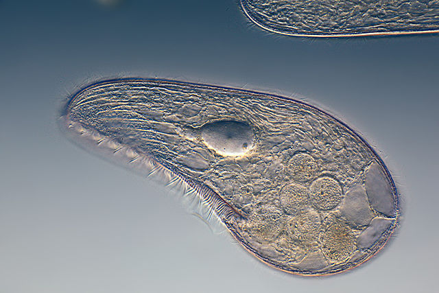 picture microorganism 