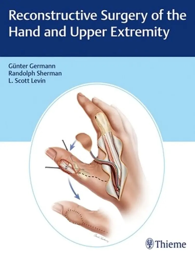 Reconstructive Surgery of the Hand and Upper Extremity af Günter Germann