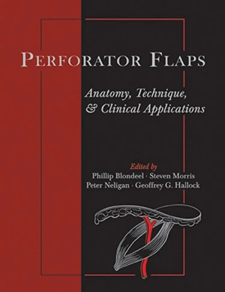 Perforator Flaps: Anatomy, Technique, & Clinical Applications, Second Edition af Phillip N. Blondeel