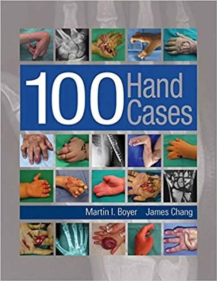 100 Hand Cases af Martin Boyer