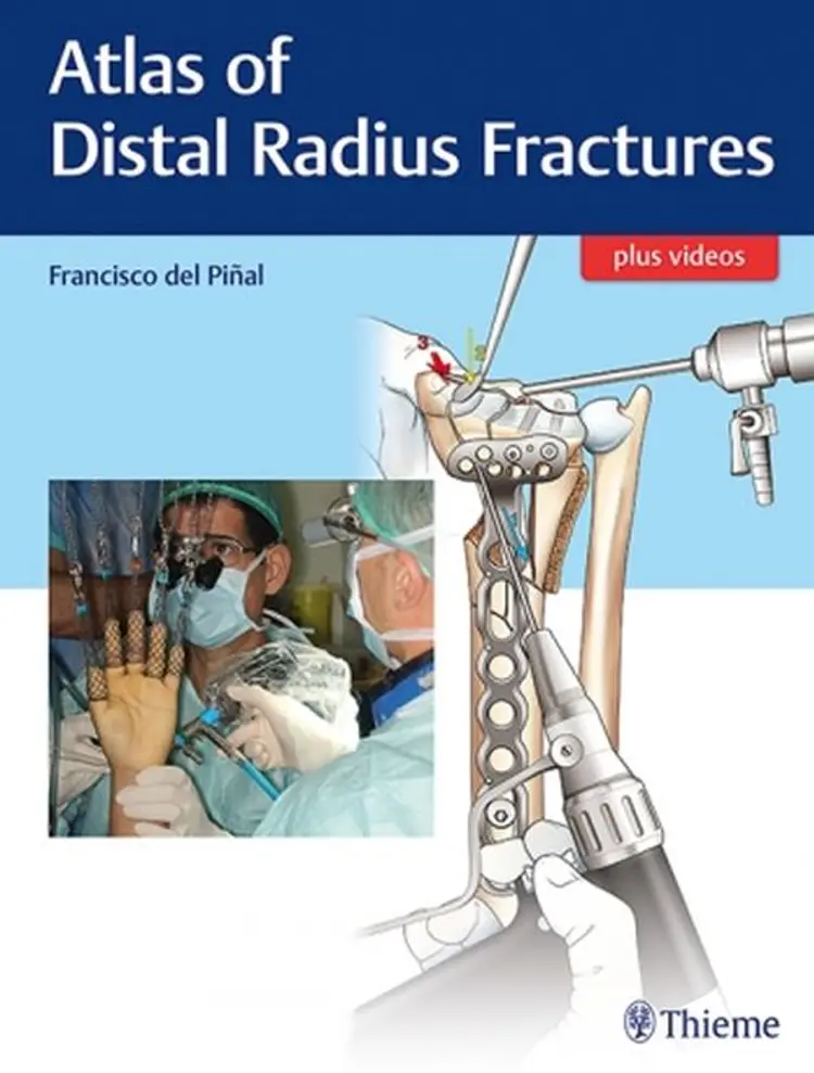 Atlas of Distal Radius Fractures af Francisco del Pinal