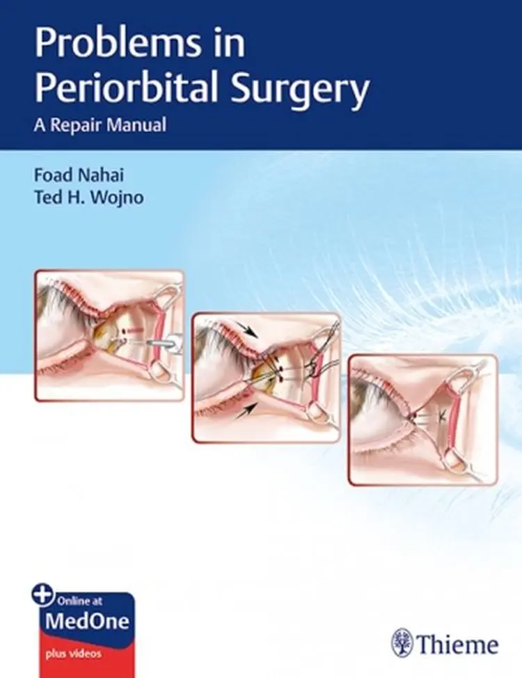 Problems in Periorbital Surgery: A Repair Manual af Foad Nahai