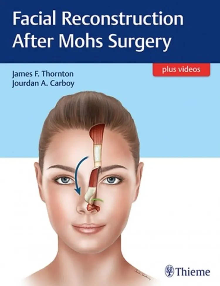 Facial Reconstruction After Mohs Surgery af Francoise Firmin