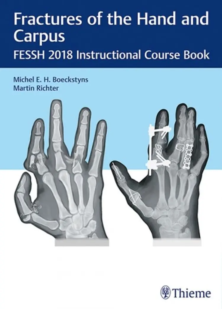 Fractures of the Hand and Carpus: FESSH 2018 Instructional Course Book af Mario Sanna