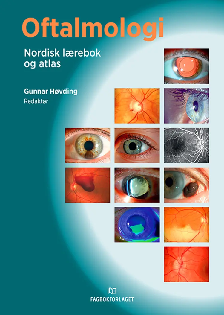 Oftalmologi : nordisk lærebok og atlas af Gunnar Høvding (red.)