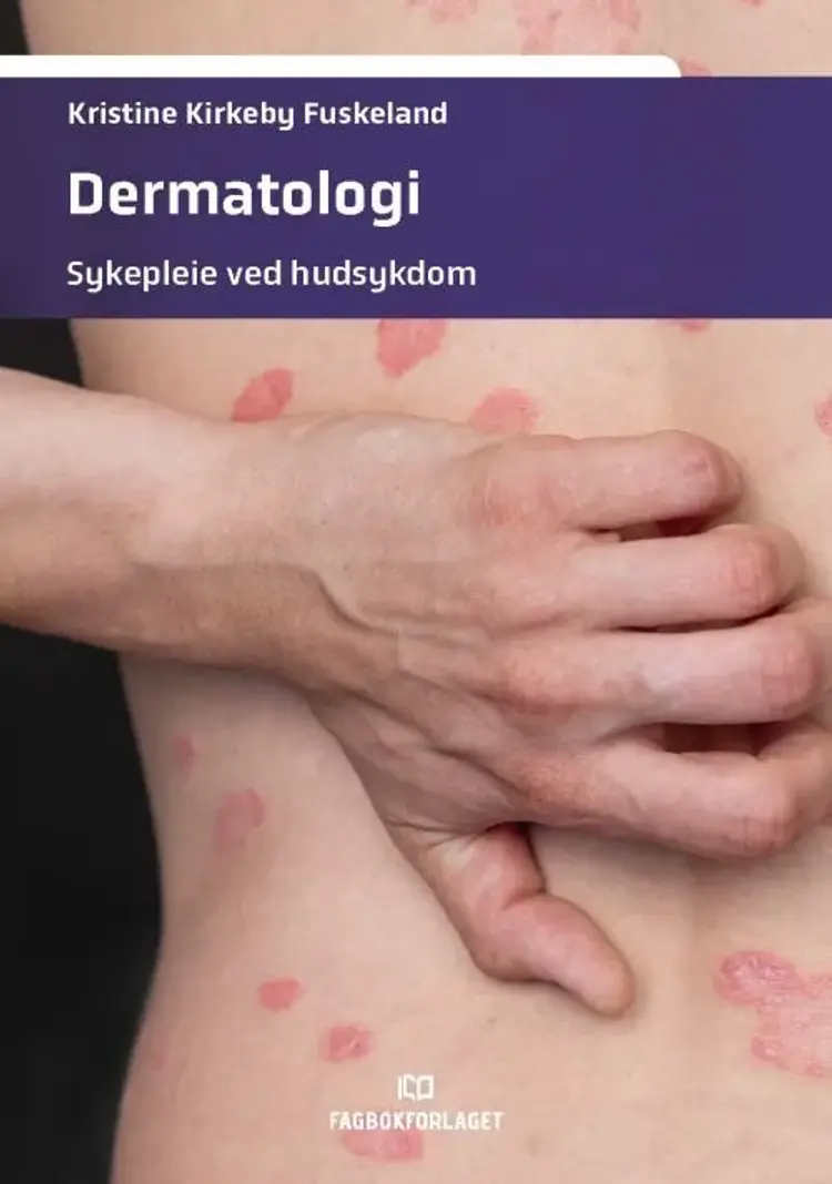 Dermatologi : sykepleie ved hudsykdom af Kristine Kirkeby Fuskeland