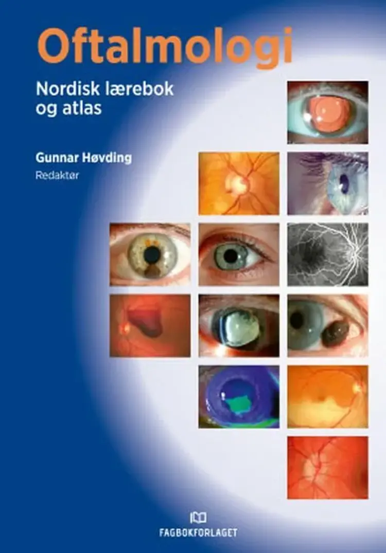 Oftalmologi : nordisk lærebok og atlas af Gunnar Høvding (red.)