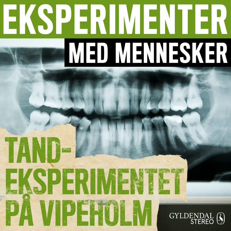 Tandeksperimentet på Vipeholm af Gyldendal Stereo