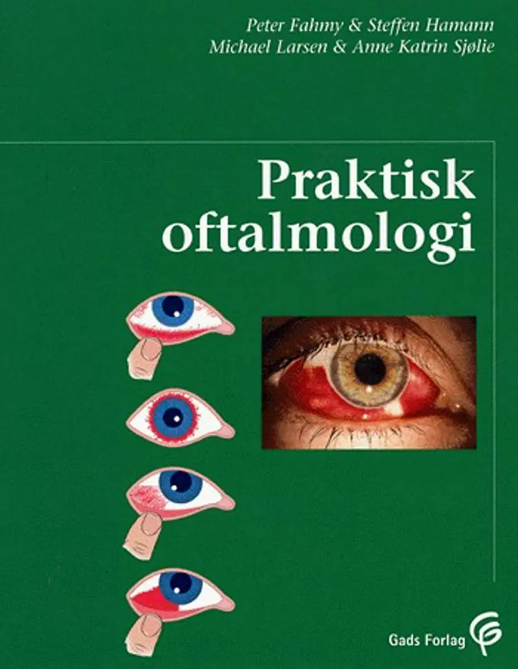 Praktisk oftalmologi af A.K. Sjølie