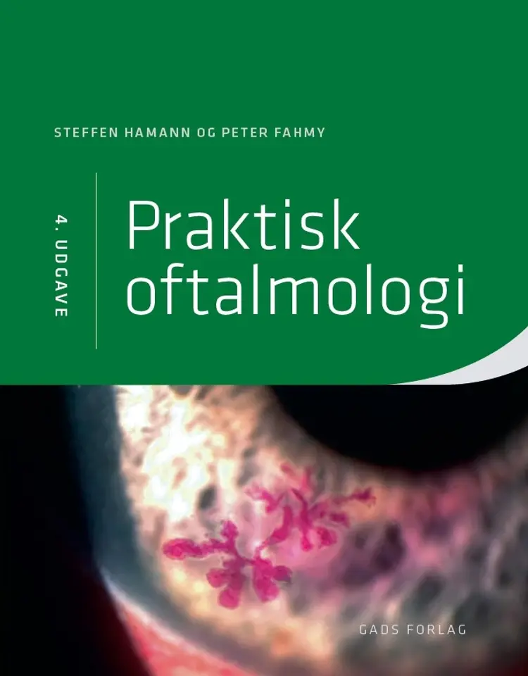 Praktisk oftalmologi, 4. udg. af Michael Larsen