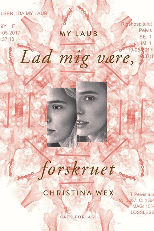 Lad mig være, forskruet cover