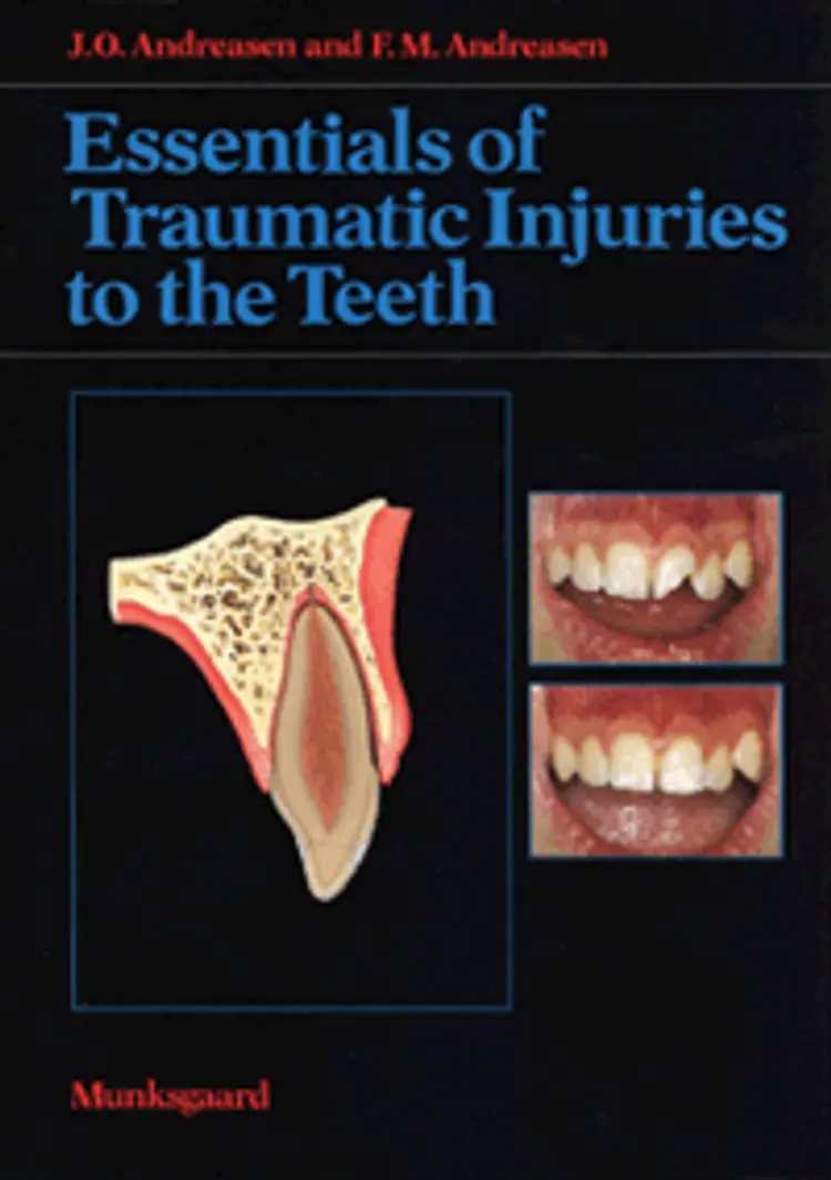 Essentials of traumatic injuries to the teeth af J. O. Andreasen
