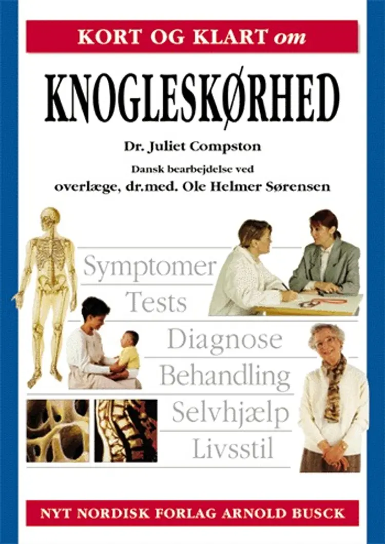 Kort og klart om knogleskørhed af Juliet Compston