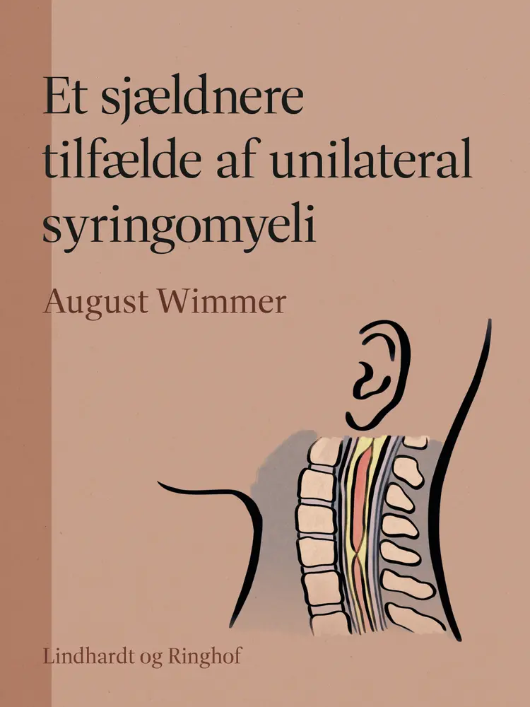 Et sjældnere tilfælde af unilateral syringomyeli af August Wimmer