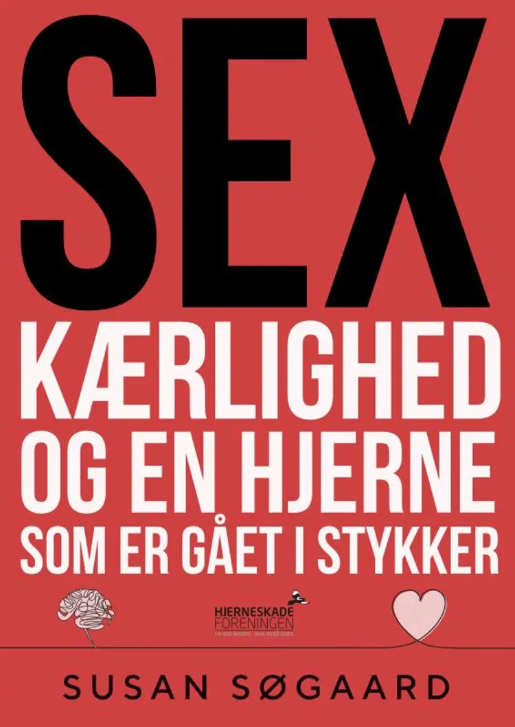 Sex, kærlighed og en hjerne som er gået i stykker af Susan Søgaard