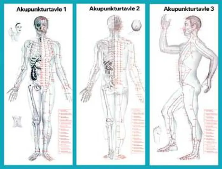 Akupunktur planche - Krop 1-3