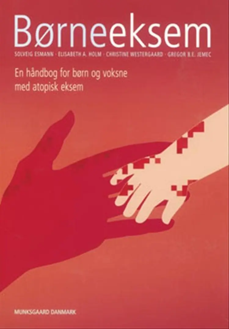 Børneeksem af Solveig Esmann