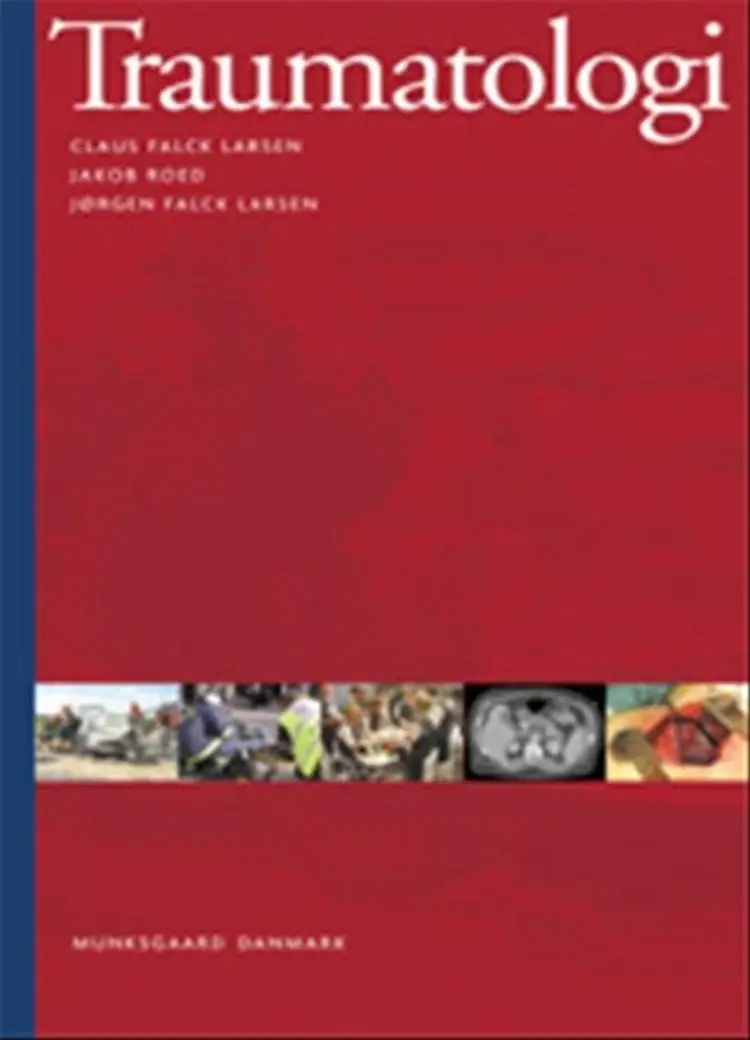 Traumatologi af Claus Falck Larsen